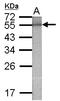 Galactosidase Beta 1 antibody, LS-C155766, Lifespan Biosciences, Western Blot image 