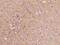 Solute Carrier Family 12 Member 5 antibody, 202874-T08, Sino Biological, Immunohistochemistry frozen image 