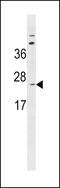 Signal peptidase complex catalytic subunit SEC11A antibody, 60-867, ProSci, Western Blot image 