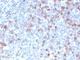 Cell Division Cycle 20 antibody, V7182IHC-7ML, NSJ Bioreagents, Immunohistochemistry paraffin image 
