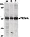 Tripartite Motif Containing 5 antibody, PA5-20049, Invitrogen Antibodies, Western Blot image 