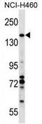 Valosin Containing Protein Interacting Protein 1 antibody, AP54501PU-N, Origene, Western Blot image 