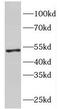 Fumarate hydratase, mitochondrial antibody, FNab03107, FineTest, Western Blot image 