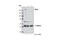Dicer 1, Ribonuclease III antibody, 3363P, Cell Signaling Technology, Western Blot image 
