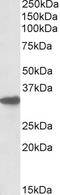 Cytochrome B5 Reductase 3 antibody, STJ72019, St John