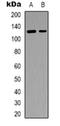 SR-Related CTD Associated Factor 4 antibody, orb318833, Biorbyt, Western Blot image 