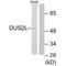 Dihydrouridine Synthase 2 antibody, A10393, Boster Biological Technology, Western Blot image 