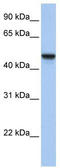 Adipocyte Plasma Membrane Associated Protein antibody, TA338423, Origene, Western Blot image 