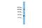 DEAH-Box Helicase 8 antibody, GTX47522, GeneTex, Western Blot image 