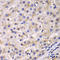 Eukaryotic Translation Elongation Factor 2 antibody, LS-C331870, Lifespan Biosciences, Immunohistochemistry paraffin image 