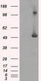 Interferon Induced Protein With Tetratricopeptide Repeats 3 antibody, LS-C114808, Lifespan Biosciences, Western Blot image 