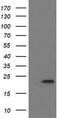 Leucine Zipper And CTNNBIP1 Domain Containing antibody, TA505895AM, Origene, Western Blot image 