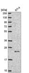 SPIN90 antibody, NBP2-56886, Novus Biologicals, Western Blot image 