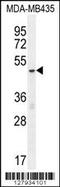 Methyl-CpG Binding Protein 2 antibody, MBS9205285, MyBioSource, Western Blot image 