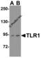 Toll Like Receptor 1 antibody, 3641, ProSci Inc, Western Blot image 