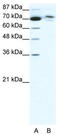 Transmembrane Protein 260 antibody, TA335534, Origene, Western Blot image 