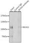 BCAS3 Microtubule Associated Cell Migration Factor antibody, GTX32467, GeneTex, Immunoprecipitation image 