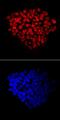 Forkhead Box P1 antibody, MAB45341, R&D Systems, Immunocytochemistry image 