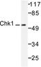 Checkpoint Kinase 1 antibody, LS-C175956, Lifespan Biosciences, Western Blot image 