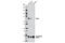 Neurofibromin 2 antibody, 6995S, Cell Signaling Technology, Western Blot image 