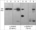 Actinin Alpha 4 antibody, AP4241, ECM Biosciences, Western Blot image 