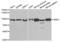 Ribonucleotide Reductase Catalytic Subunit M1 antibody, PA5-75989, Invitrogen Antibodies, Western Blot image 