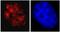 BMI1 Proto-Oncogene, Polycomb Ring Finger antibody, ab14389, Abcam, Immunocytochemistry image 