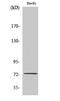 Slingshot Protein Phosphatase 3 antibody, A11609-2, Boster Biological Technology, Western Blot image 