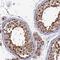 Caseinolytic Mitochondrial Matrix Peptidase Chaperone Subunit antibody, PA5-59128, Invitrogen Antibodies, Immunohistochemistry frozen image 