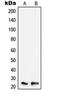 TNF Alpha Induced Protein 8 antibody, orb215103, Biorbyt, Western Blot image 