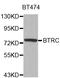 Beta-Transducin Repeat Containing E3 Ubiquitin Protein Ligase antibody, LS-C331612, Lifespan Biosciences, Western Blot image 