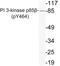 Phosphoinositide-3-Kinase Regulatory Subunit 2 antibody, LS-C178060, Lifespan Biosciences, Western Blot image 