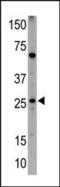 BCL2 Interacting Protein 1 antibody, PA5-11396, Invitrogen Antibodies, Western Blot image 