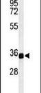 Transmembrane Protein 173 antibody, PA5-26751, Invitrogen Antibodies, Western Blot image 