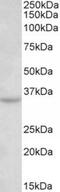 Tetraspanin 5 antibody, TA311341, Origene, Western Blot image 