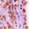 REL Proto-Oncogene, NF-KB Subunit antibody, orb393148, Biorbyt, Immunohistochemistry paraffin image 