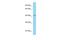 Vacuolar Protein Sorting 36 Homolog antibody, A07809, Boster Biological Technology, Western Blot image 