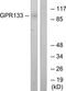 Adhesion G Protein-Coupled Receptor D1 antibody, TA316304, Origene, Western Blot image 