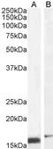 Dynein Axonemal Assembly Factor 4 antibody, 45-511, ProSci, Immunohistochemistry paraffin image 