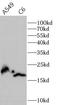 NME/NM23 Nucleoside Diphosphate Kinase 1 antibody, FNab10803, FineTest, Western Blot image 