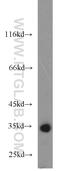 RCC1 And BTB Domain Containing Protein 1 antibody, 55255-1-AP, Proteintech Group, Western Blot image 