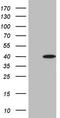 Myozenin 1 antibody, TA808911, Origene, Western Blot image 