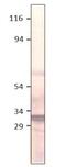 Aquaporin 11 antibody, GTX47927, GeneTex, Western Blot image 