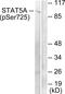 Signal Transducer And Activator Of Transcription 5A antibody, PA5-38527, Invitrogen Antibodies, Western Blot image 