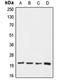 Claudin 1 antibody, orb214856, Biorbyt, Western Blot image 