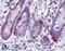 Vitamin D Receptor antibody, LS-B2976, Lifespan Biosciences, Immunohistochemistry paraffin image 