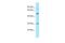 G Protein Subunit Alpha 13 antibody, PA5-45827, Invitrogen Antibodies, Western Blot image 