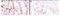 Mesothelin antibody, NB110-85538, Novus Biologicals, Immunohistochemistry paraffin image 