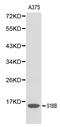 S100 Calcium Binding Protein B antibody, LS-C192228, Lifespan Biosciences, Western Blot image 