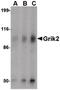 Glutamate Ionotropic Receptor Kainate Type Subunit 2 antibody, PA5-20449, Invitrogen Antibodies, Western Blot image 